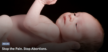 baby-stop-abortion
